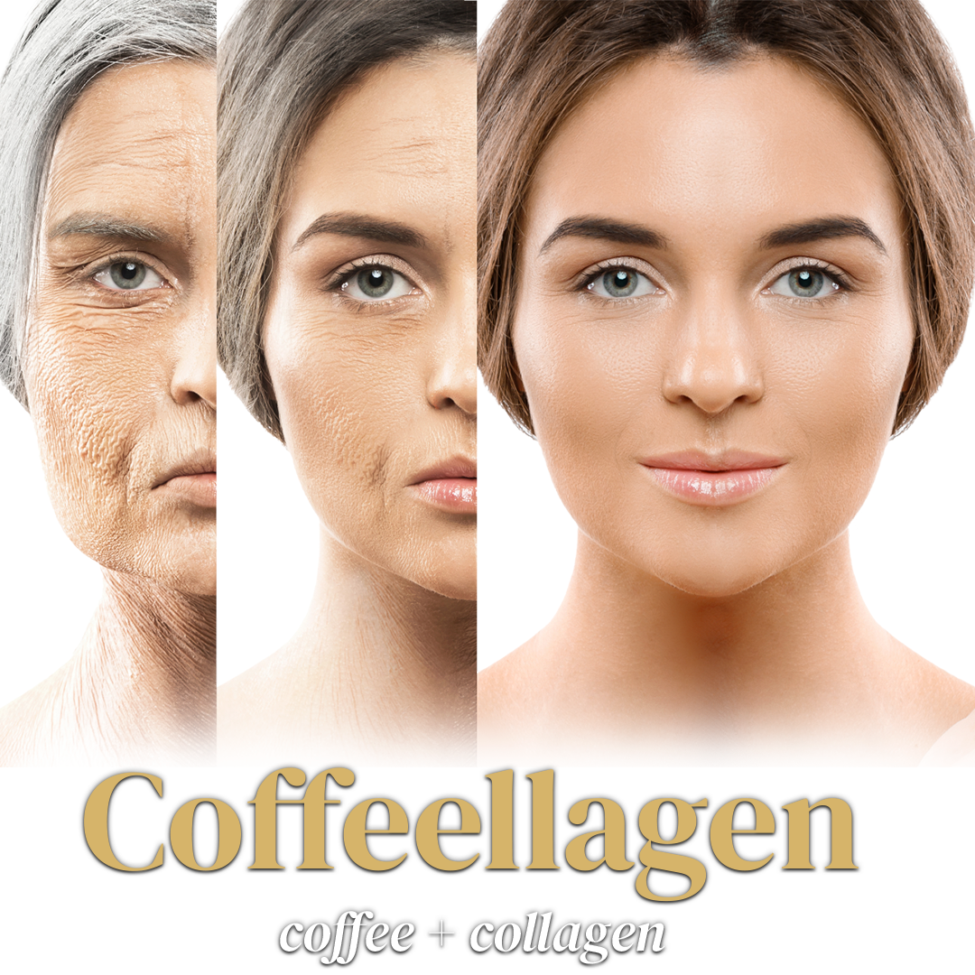 Coffeellagen
